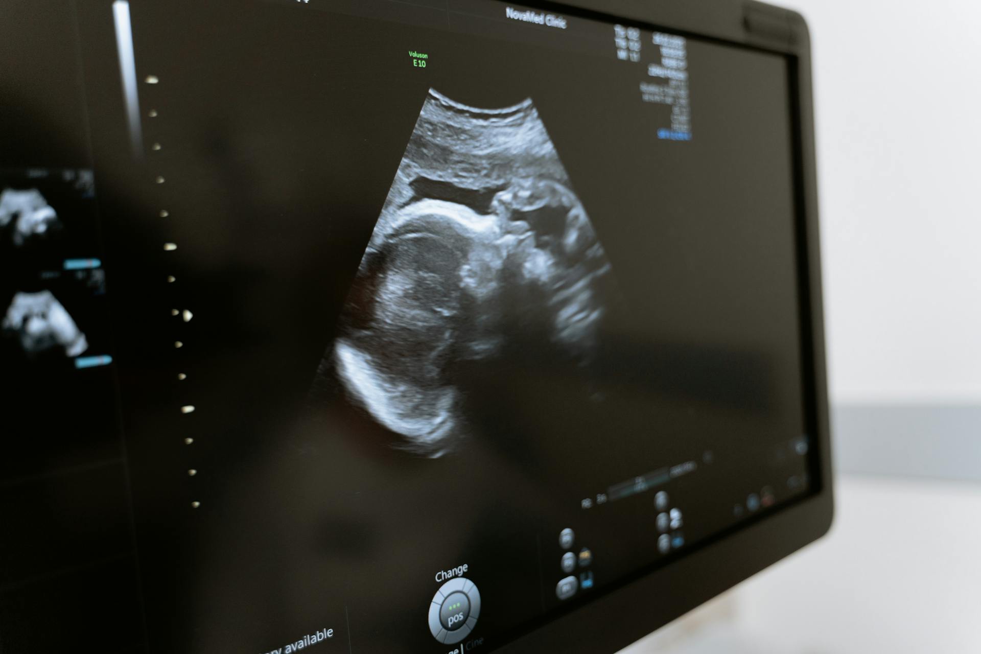 Innovative Medical Devices Improving Maternal Health Outcomes Worldwide